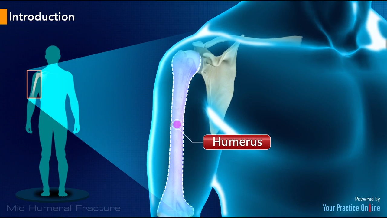 surgical humerus of arm