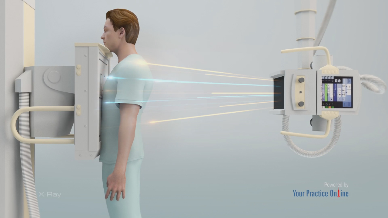 X-Ray Procedure Video | Diagnostic Imaging Procedures Video