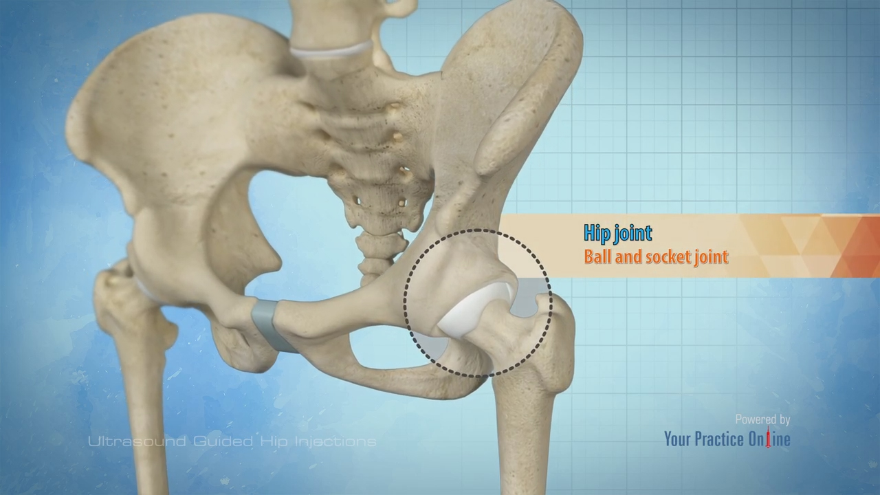Ultrasound Guided Hip Injections Video | Medical Video Library
