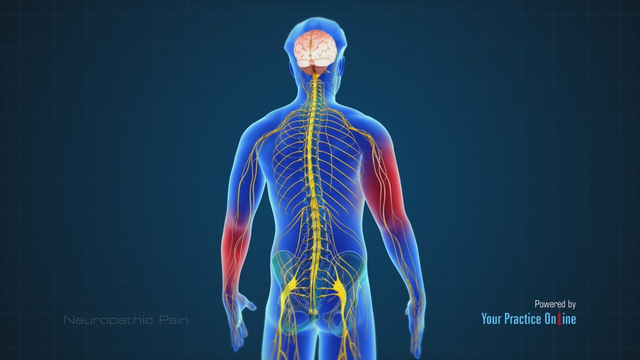 IS IT NERVE PAIN OR MUSCLE PAIN?