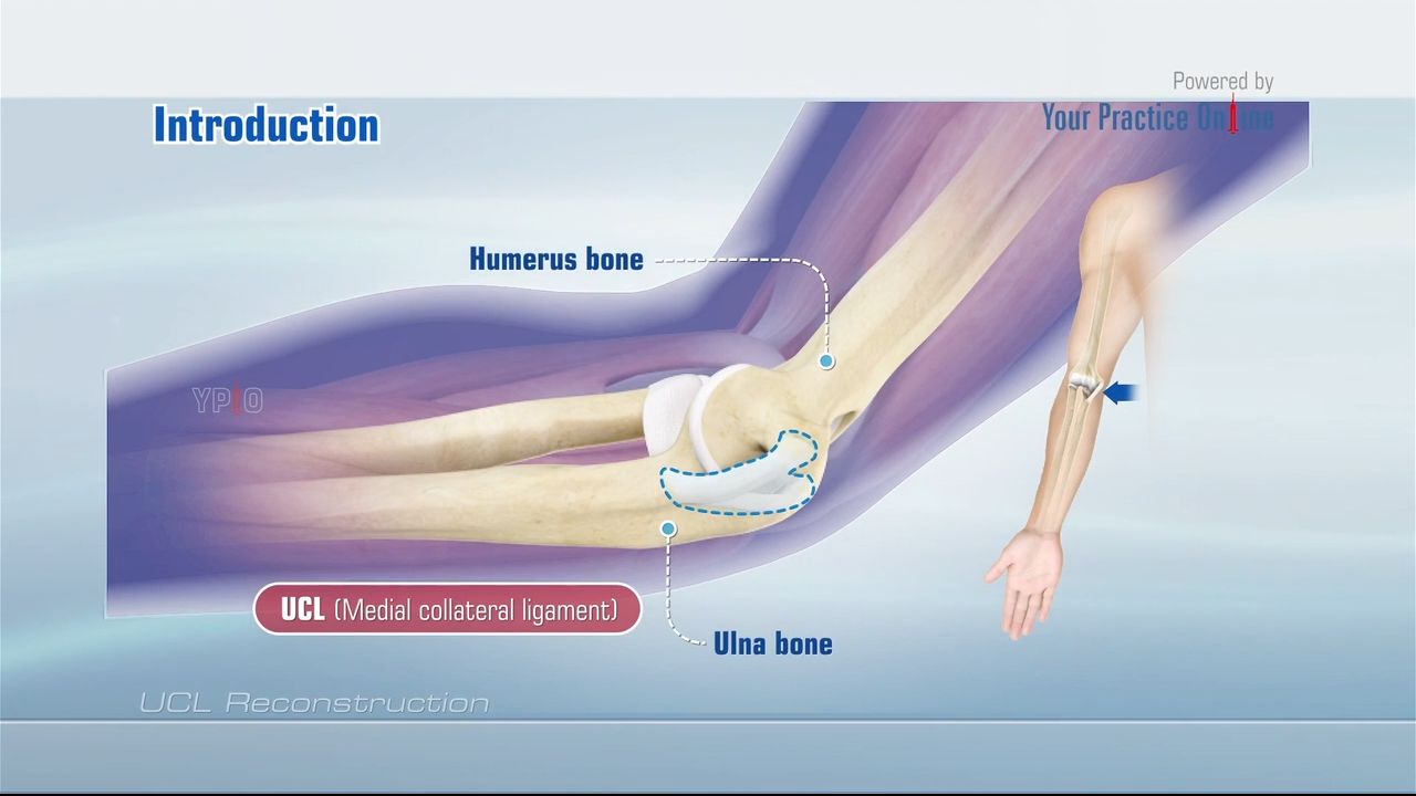 thumb-ulnar-collateral-ligament-test-for-ucl-thumb-assessment-youtube