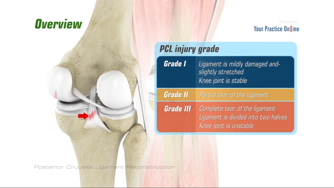 cruciform ligament