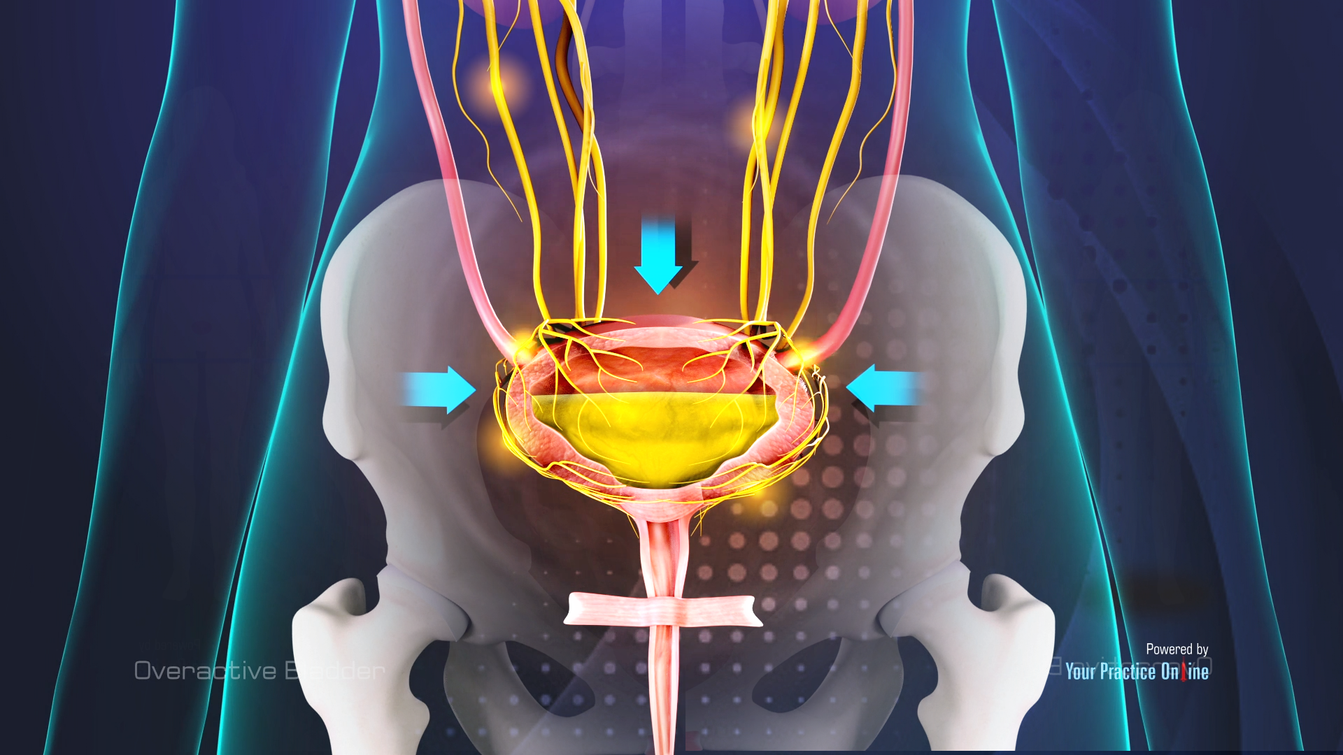 overactive-bladder-video-medical-video-library